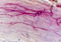 手足癣的病原体